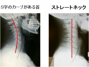 o04000300123671172291